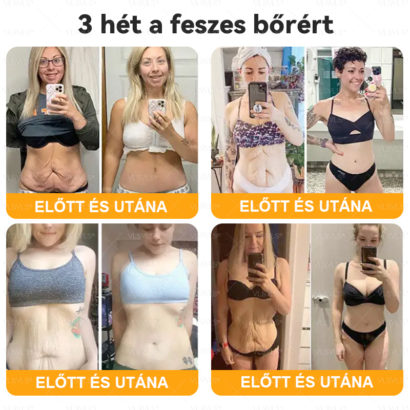 🌟 Magyarországon készült és innen szállítjuk ✨ VLSVLS® Méhméreg Bőrhelyreállító Krém 🔥 UTOLSÓ NAP – 80% KEDVEZMÉNY
