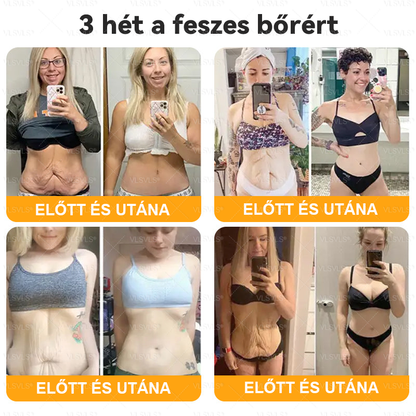 🌟 Magyarországon készült és innen szállítjuk ✨ VLSVLS® Méhméreg Bőrhelyreállító Krém 🔥 UTOLSÓ NAP – 80% KEDVEZMÉNY