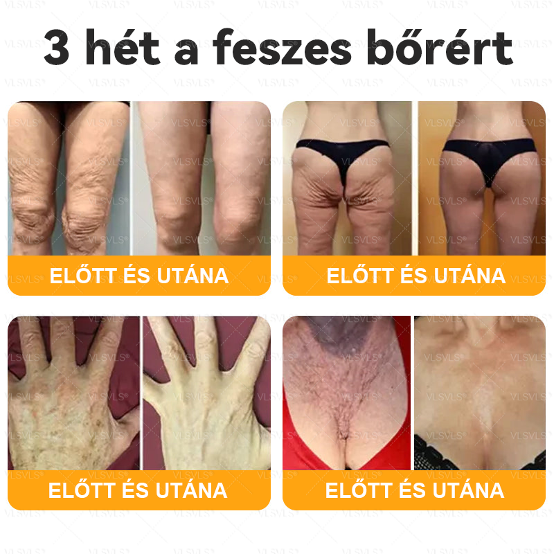 🌟 Magyarországon készült és innen szállítjuk ✨ VLSVLS® Méhméreg Bőrhelyreállító Krém 🔥 UTOLSÓ NAP – 80% KEDVEZMÉNY