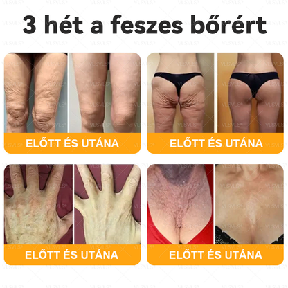🌟 Magyarországon készült és innen szállítjuk ✨ VLSVLS® Méhméreg Bőrhelyreállító Krém 🔥 UTOLSÓ NAP – 80% KEDVEZMÉNY