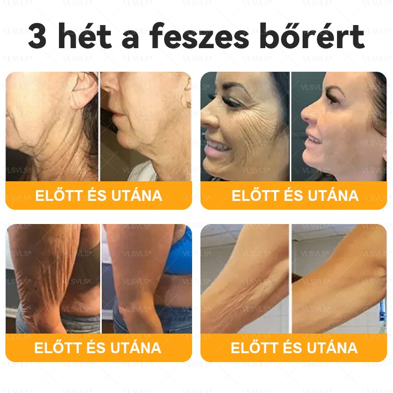 🌟 Magyarországon készült és innen szállítjuk ✨ VLSVLS® Méhméreg Bőrhelyreállító Krém 🔥 UTOLSÓ NAP – 80% KEDVEZMÉNY