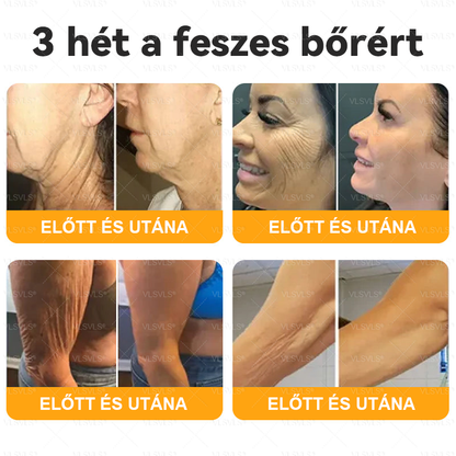 🌟 Magyarországon készült és innen szállítjuk ✨ VLSVLS® Méhméreg Bőrhelyreállító Krém 🔥 UTOLSÓ NAP – 80% KEDVEZMÉNY
